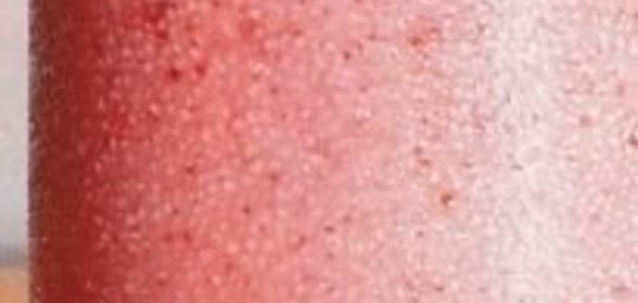 Ватрушки с вареньем