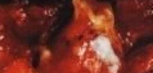 Бутерброд с маслинами